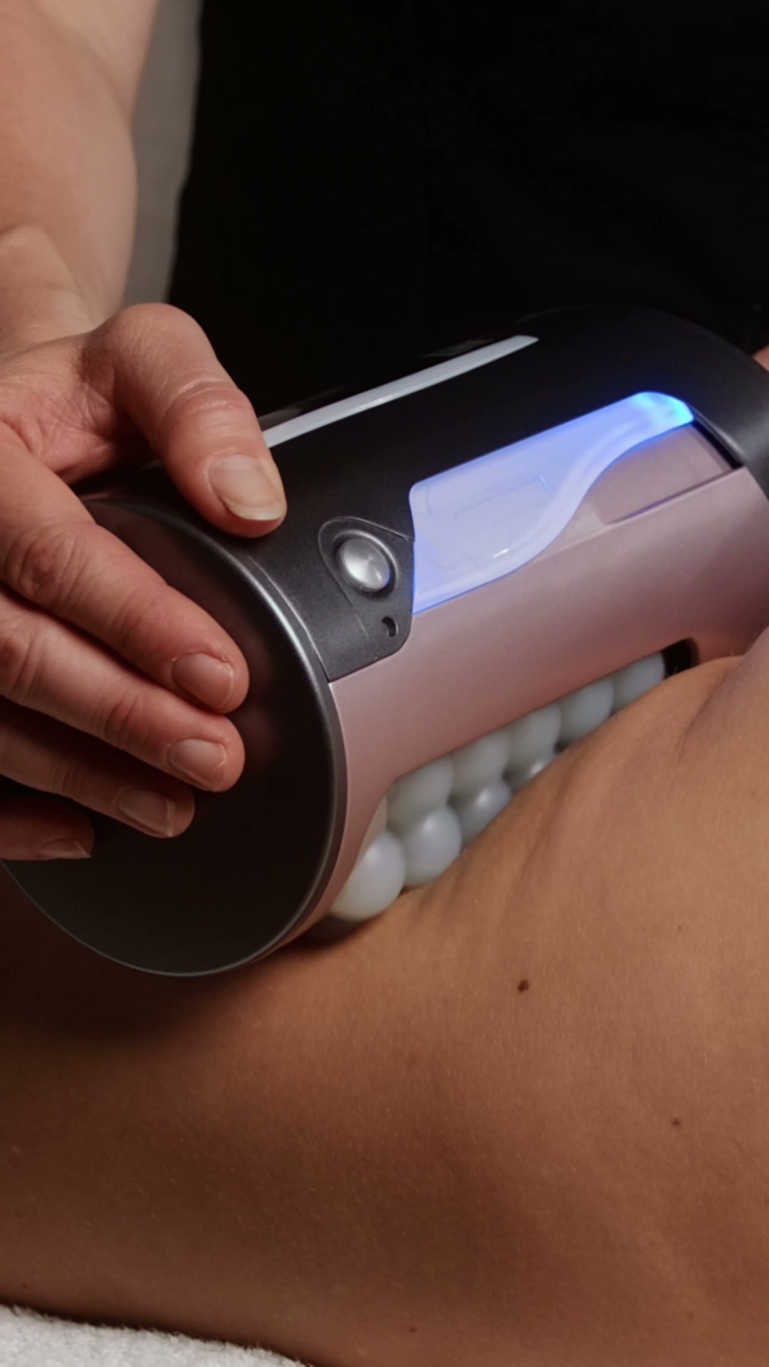 Endospheres Behandlung bei MI:SKIN in Zürich